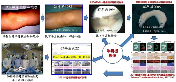 揭秘医学进步，半月板再生最新成果重塑未来之路